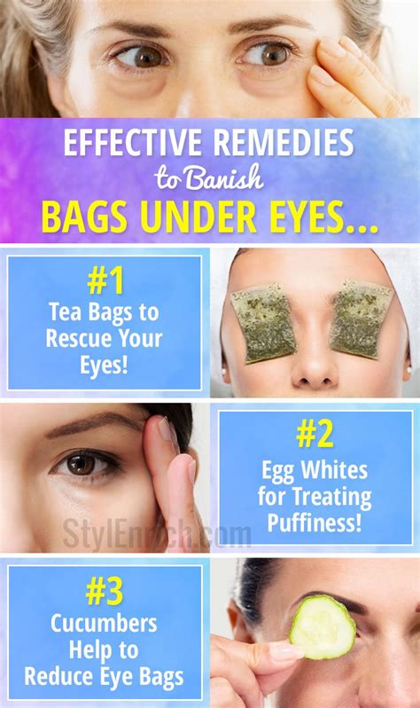 how to remove eyebags naturally